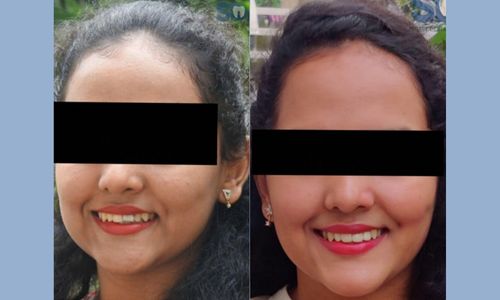 Advanced Cosmetic Dentistry