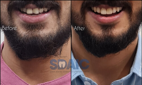 Advanced Cosmetic Dentistry