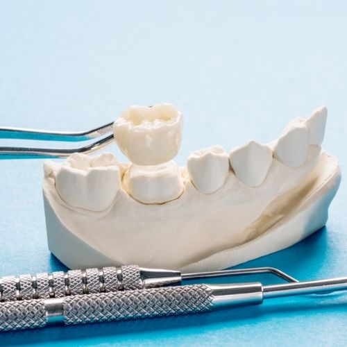 SDAIC - Restorative Dentistry